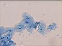 mbucal_11x40.jpg
