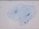 mbucal_8x100.jpg