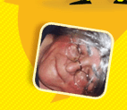 Imma Pujol