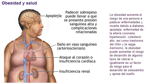 http://www.juntadeandalucia.es/averroes/%7E29701428/salud/nuevima/obesidad.gif