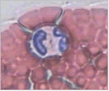 eosinòfils